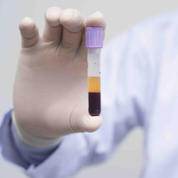 Eigenbluttherapie mit Platelet rich Plasma (PrP)